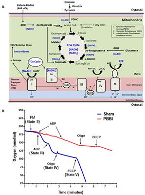 Comprehensive Profile of Acute Mitochondrial Dysfunction in a Preclinical Model of Severe Penetrating TBI